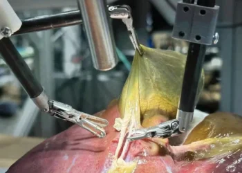 Robô com inteligência artificial realiza cirurgia inédita sem intervenção humana