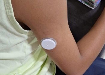 Aparecida adota sensores de glicemia e reduz internações de crianças com diabetes tipo 1