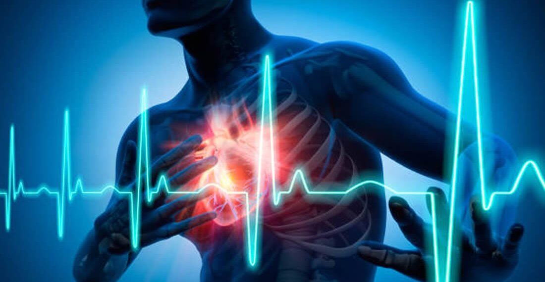 Segunda-feira concentra maior número de infartos, apontam estudos