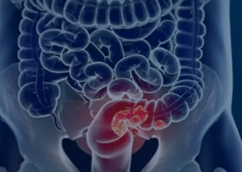 Vegetais crucíferos podem reduzir em até 20% o risco de câncer de intestino, aponta estudo