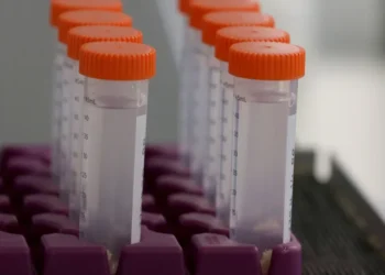 Estudo em Portugal mostra que reposição de vitamina C pode retardar avanço do Alzheimer