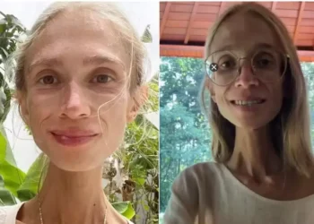 Mulher morre em hotel na Indonésia após seguir dieta frutariana radical