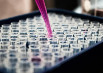 Exame de sangue para Alzheimer: Pesquisa brasileira valida biomarcador para diagnóstico em larga escala