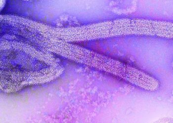 Etiópia confirma surto do vírus de Marburgo; três mortes já foram registradas