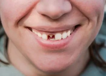 Japão avança no desenvolvimento de medicamento capaz de fazer nascer novos dentes