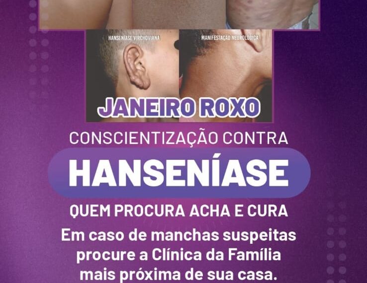 Rio Verde intensifica campanha Janeiro Roxo contra a hanseníase