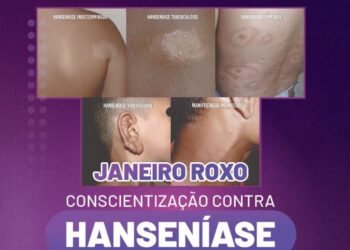 Rio Verde intensifica campanha Janeiro Roxo contra a hanseníase