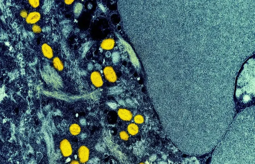 Cinco vírus que colocam a saúde global em alerta em 2026, segundo especialistas