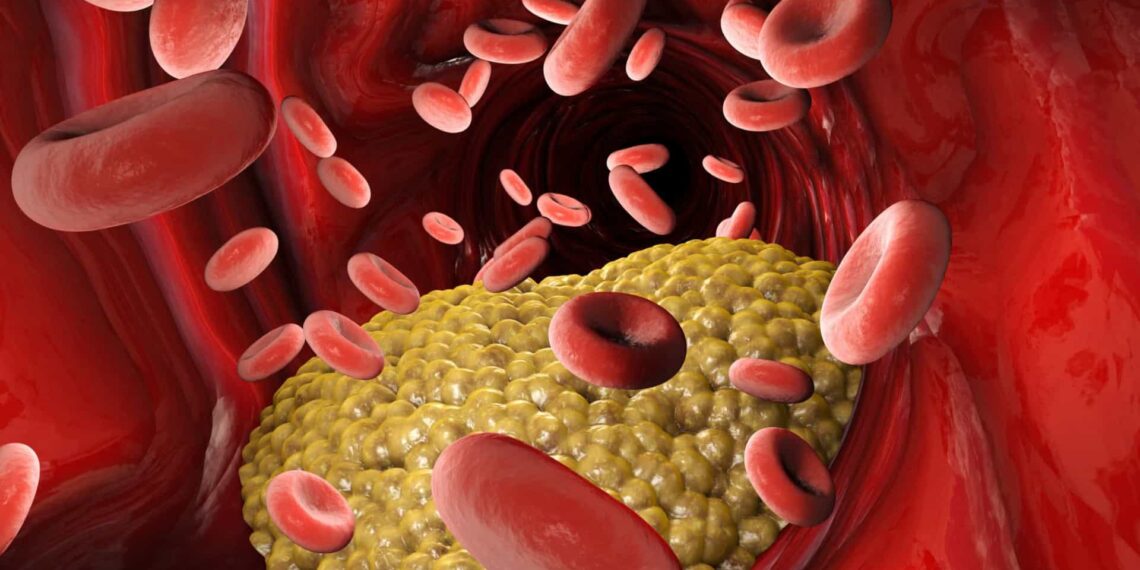 Alimentos ganham protagonismo no controle do colesterol e ajudam a reduzir risco de infarto e AVC