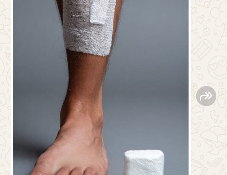 Alerta silencioso: quando uma ferida que não cicatriza pode sinalizar doenças graves