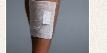 Alerta silencioso: quando uma ferida que não cicatriza pode sinalizar doenças graves