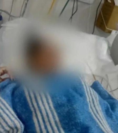 Homem agride mulher e causa fraturas após rejeição de cantada no Rio de Janeiro